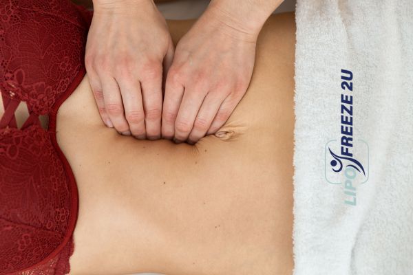 diastasis recti treatment Stourbridge