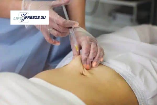 How Does Aqualyx Fat Dissolving Injection Work to Break Down Fat Stourbridge?