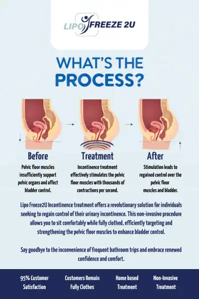 Diagram of how incontinence treatment Stourbridge works.