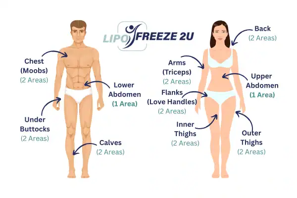 Areas you can have fat freezing treatment Stourbridge