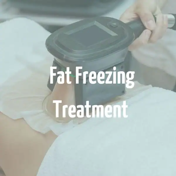fat freezing treatment Stourbridge