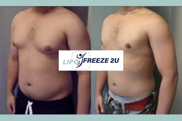 How Long Does It Take to See Results Stourbridge?