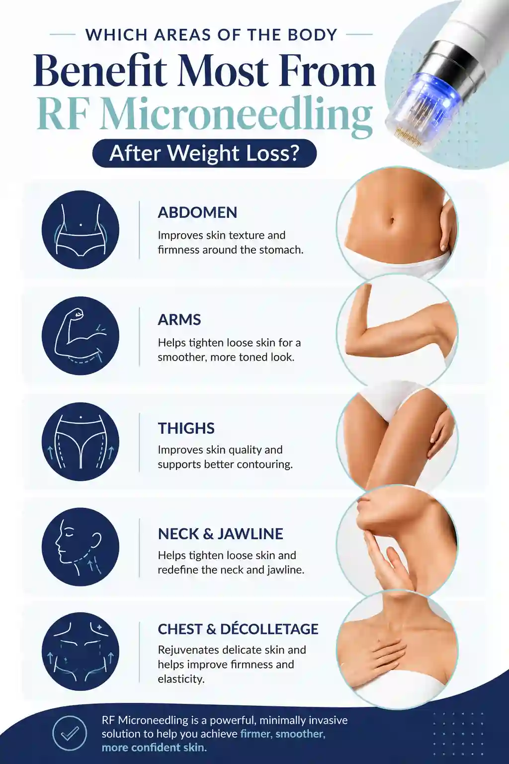 Which Areas of the Body Benefit Most From RF Microneedling After Weight Loss Stourbridge